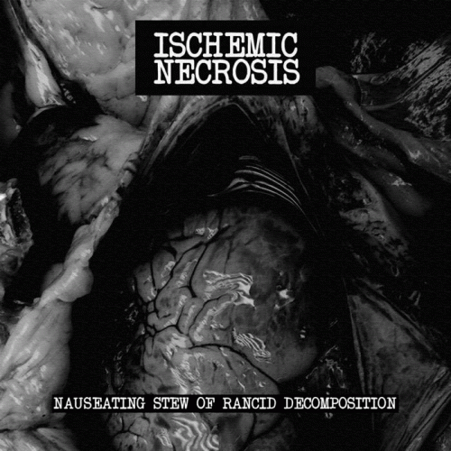 Ischemic Necrosis : Nauseating Stew of Rancid Decomposition